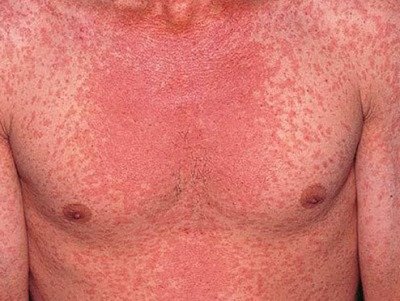  ��������� ��������������� ������ ����������� ����� 