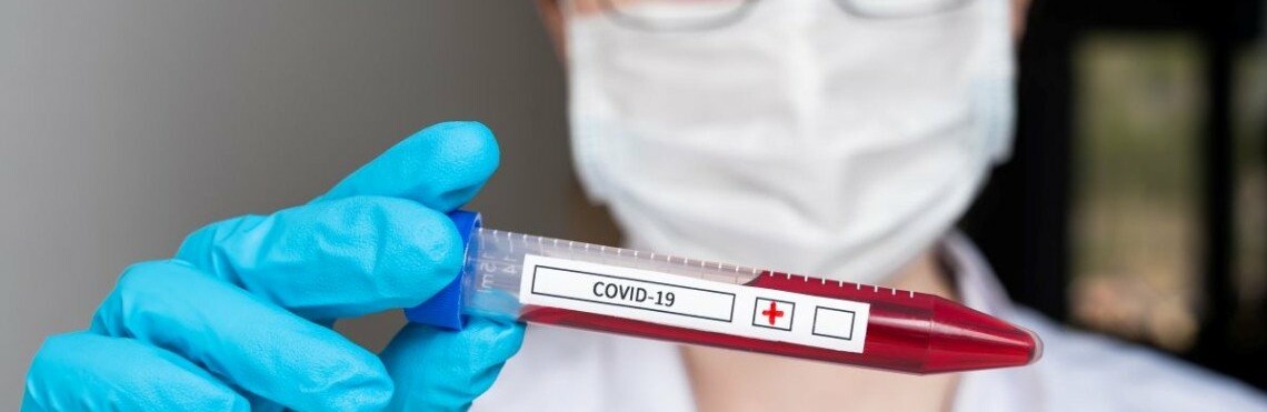  ����������� ������� �������� ������ ���������� ���������� covid-19 