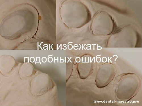 Мы научим как избежать подобных ошибок! «Интересная ортопедическая стоматология. Взгляд доктора. Взгляд техника» – Николов В. + Нестеренко А., Украина, г. Донецк, 30 ноября 2013